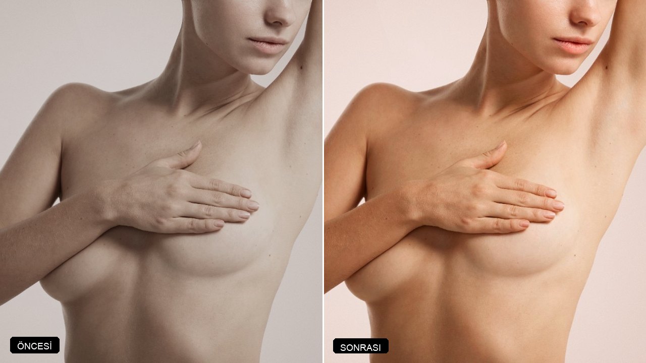 Örnek before after 3